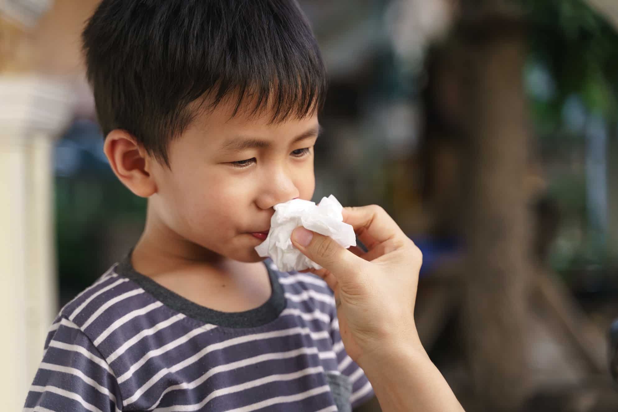 otolaryngologists near you can treat nose bleeds in your children